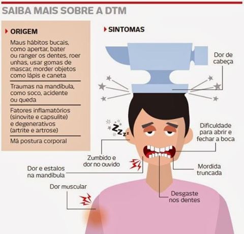 Articulação estalando é sempre sintoma de DTM (Disfunção  Temporomandibular)?